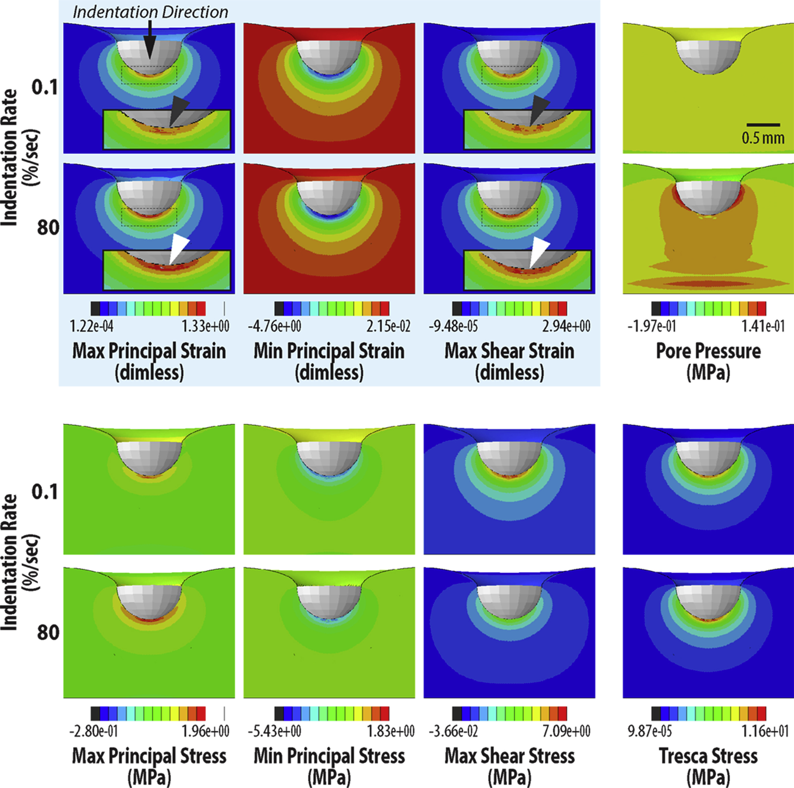 Chondrocyte viability is lost during high-rate impact loading by transfer of amplified strain, but not stress, to pericellular and cellular regions